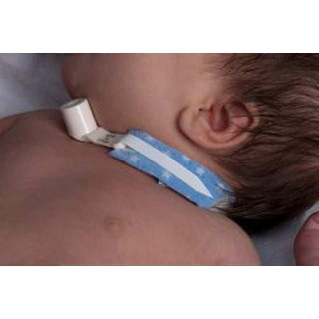 Dale Pedistars Tracheostomy Tube Holder