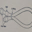 VenoSeal Venous Leak Constriction Loop