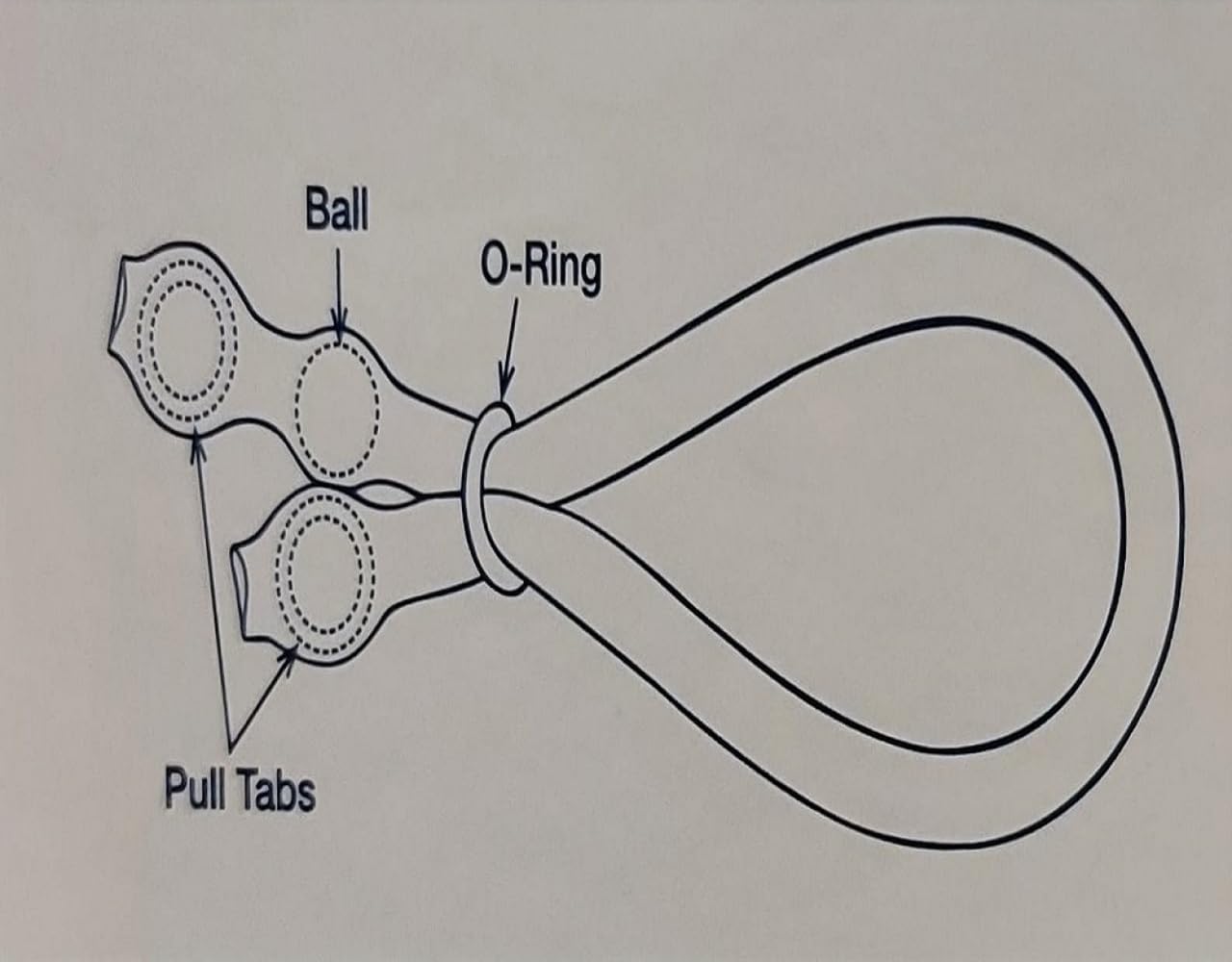 VenoSeal Venous Leak Constriction Loop